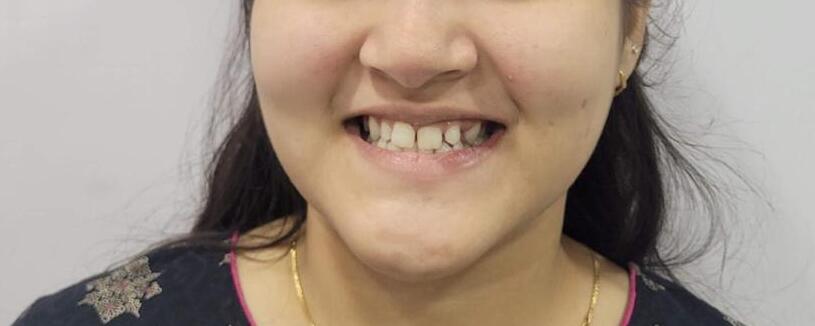 Before